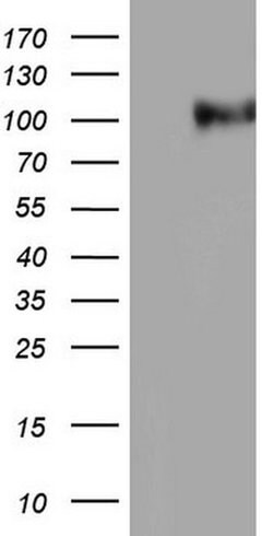 NCAM1 Monoclonal Antibody (OTI7D11), TrueMAB , OriGene:Antibodies:Primary