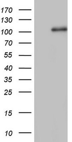 NCAM1 Monoclonal Antibody (OTI3H2), TrueMAB , OriGene 100 &mu;L; Unconjugated:Antibodies,