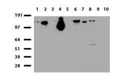 NCAM1 Mouse anti-Human, Clone: UMAB83, lyophilized, UltraMAB 100 &mu;g;