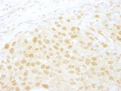 NCBP1/CBP80 Polyclonal Antibody, Bethyl Laboratories 10 &mu;L; Unconjugated:Antibodies,