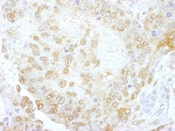 NCBP1/CBP80 Polyclonal Antibody, Bethyl Laboratories 10 &mu;L; Unconjugated:Antibodies,