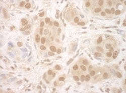 NCBP2 Rabbit anti-Human, Polyclonal, Bethyl Laboratories 100 &mu;L; Unconjugated:Antibodies,