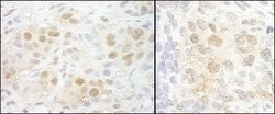 NCBP2 Rabbit anti-Human, Mouse, Polyclonal, Bethyl Laboratories 100 &mu;L;