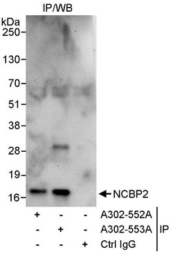 NCBP2 Rabbit anti-Human, Polyclonal, Bethyl Laboratories 100 &mu;L; Unconjugated:Antibodies,