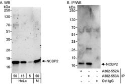 NCBP2 Rabbit anti-Human, Mouse, Polyclonal, Bethyl Laboratories 100 &mu;L;