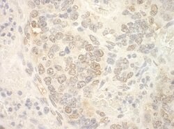 NCBP2 Polyclonal Antibody, Bethyl Laboratories 10 &mu;L; Unconjugated:Antibodies,