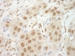 NCBP2 Polyclonal Antibody, Bethyl Laboratories 10 &mu;L; Unconjugated:Antibodies,