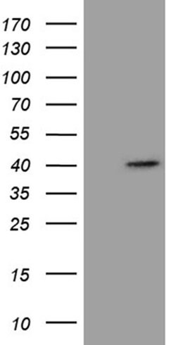 NCF4 Monoclonal Antibody (OTI3E8), TrueMAB , OriGene 100 &mu;L; Unconjugated:Antibodies,