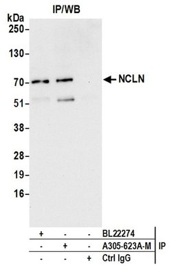 NCLN Polyclonal Antibody, Bethyl Laboratories 20 &mu;L; Unconjugated:Antibodies,