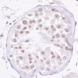 NCOA2/SRC2 Rabbit anti-Human, Mouse, Polyclonal, Bethyl Laboratories 100