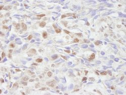 NCOA2/SRC2 Polyclonal Antibody, Bethyl Laboratories 10 &mu;L; Unconjugated:Antibodies,