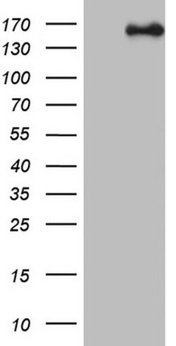 NCOA2 Monoclonal Antibody (OTI3C7), TrueMAB , OriGene 100 &mu;L; Unconjugated:Antibodies,