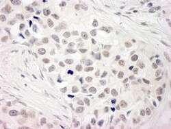 NCOA5/CIA Rabbit anti-Human, Mouse, Polyclonal, Bethyl Laboratories 100