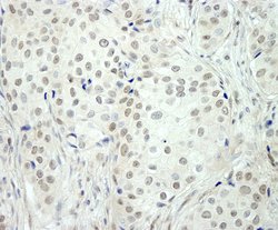 NCOA5/CIA Polyclonal Antibody, Bethyl Laboratories:Antibodies:Primary Antibodies