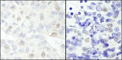NCOA62 Rabbit anti-Human, Mouse, Polyclonal, Bethyl Laboratories 100 &mu;L;