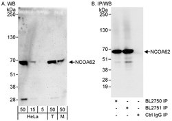 NCOA62 Rabbit anti-Human, Mouse, Polyclonal, Bethyl Laboratories 100 &mu;L;