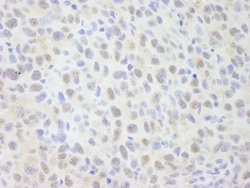 NCOA62 Polyclonal Antibody, Bethyl Laboratories:Antibodies:Primary Antibodies