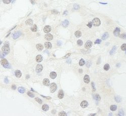 NCOA62 Polyclonal Antibody, Bethyl Laboratories 100 &mu;L; Unconjugated:Antibodies,