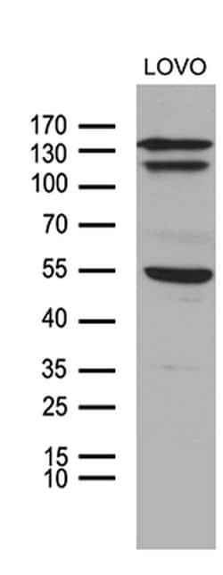 NCOA7 Monoclonal Antibody (OTI2F4), TrueMAB , OriGene 100 &mu;L; Unconjugated:Antibodies,