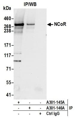 NCoR Rabbit anti-Human, Mouse, Polyclonal, Bethyl Laboratories 100 &mu;l;