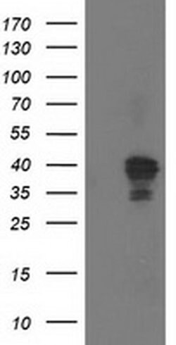 NDEL1 Monoclonal Antibody (OTI1C7), TrueMAB , OriGene 100 &mu;L; Unconjugated:Antibodies,