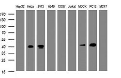 NDEL1 Mouse anti-Canine, Human, Mouse, Rat, Clone: OTI1G7, lyophilized,
