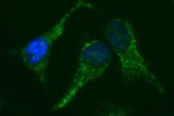 NDOR1 Monoclonal Antibody (OTI2G4), TrueMAB , OriGene 100 &mu;L; Unconjugated:Antibodies,