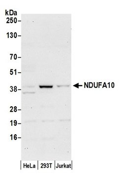 NDUFA10 Polyclonal Antibody, Bethyl Laboratories:Antibodies:Primary Antibodies