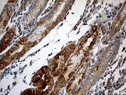 NDUFA2 Monoclonal Antibody (OTI5A5), TrueMAB , OriGene 100 &mu;L | Buy Online | Origene Technologies | Fisher Scientific