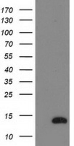 NDUFA7 Mouse anti-Human, Clone: OTI2E3, lyophilized, TrueMAB 100 &mu;g;