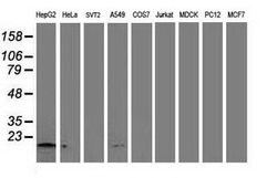 NDUFA7 Mouse anti-Human, Clone: OTI2G4, lyophilized, TrueMAB 100 &mu;g;