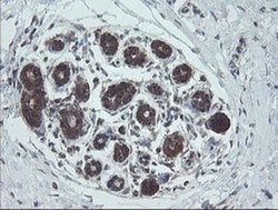 NDUFB10 Monoclonal Antibody (OTI1H6), TrueMAB , OriGene 100 &mu;L; Unconjugated:Antibodies,