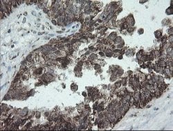 NDUFB10 Monoclonal Antibody (OTI1H6), TrueMAB , OriGene 100 &mu;L; Unconjugated:Antibodies,