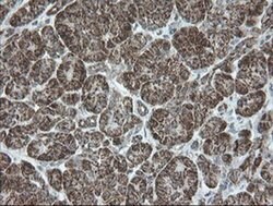 NDUFB10 Monoclonal Antibody (OTI1H6), TrueMAB , OriGene 100 &mu;L; Unconjugated:Antibodies,