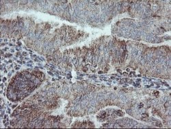 NDUFB10 Monoclonal Antibody (OTI1H6), TrueMAB , OriGene 100 &mu;L; Unconjugated:Antibodies,