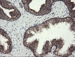 NDUFB10 Monoclonal Antibody (OTI1H6), TrueMAB , OriGene 100 &mu;L; Unconjugated:Antibodies,