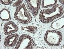 NDUFB10 Monoclonal Antibody (OTI1H6), TrueMAB , OriGene 100 &mu;L; Unconjugated:Antibodies,
