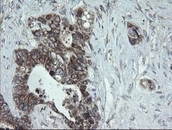 NDUFB10 Monoclonal Antibody (OTI1H6), TrueMAB , OriGene:Antibodies:Primary