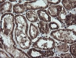 NDUFB10 Monoclonal Antibody (OTI1H6), TrueMAB , OriGene 100 &mu;L; Unconjugated:Antibodies,