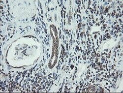 NDUFB10 Monoclonal Antibody (OTI1H6), TrueMAB , OriGene:Antibodies:Primary