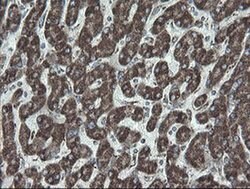 NDUFB10 Monoclonal Antibody (OTI1H6), TrueMAB , OriGene 100 &mu;L; Unconjugated:Antibodies,