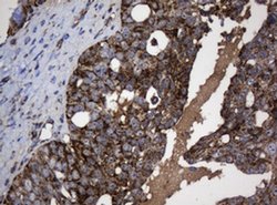 NDUFB10 Monoclonal Antibody (OTI2G1), TrueMAB , OriGene 100 &mu;L; Unconjugated:Antibodies,