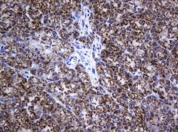 NDUFB10 Monoclonal Antibody (OTI2G1), TrueMAB , OriGene 100 &mu;L; Unconjugated:Antibodies,