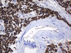 NDUFB10 Monoclonal Antibody (OTI2G1), TrueMAB , OriGene 100 &mu;L; Unconjugated:Antibodies,