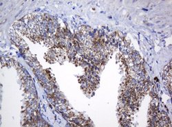 NDUFB10 Monoclonal Antibody (OTI2G1), TrueMAB , OriGene 100 &mu;L; Unconjugated:Antibodies,