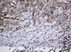 NDUFB10 Monoclonal Antibody (OTI2G1), TrueMAB , OriGene 100 &mu;L; Unconjugated:Antibodies,