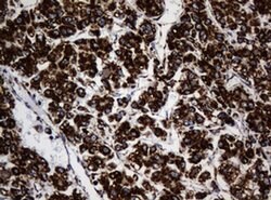 NDUFB10 Monoclonal Antibody (OTI2G1), TrueMAB , OriGene 100 &mu;L; Unconjugated:Antibodies,