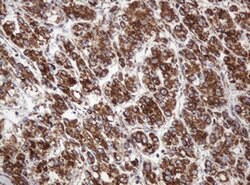 NDUFB10 Mouse anti-Human, Clone: OTI4D1, lyophilized, TrueMAB 100 &mu;g;