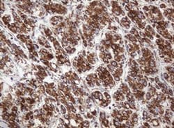 NDUFB10 Monoclonal Antibody (OTI4D1), TrueMAB , OriGene 100 &mu;L; Unconjugated:Antibodies,