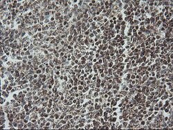 NDUFB10 Mouse anti-Canine, Human, Mouse, Rat, Clone: OTI4F1, lyophilized, TrueMAB 100 &mu;g | Buy Online | OriGene | Fisher Scientific